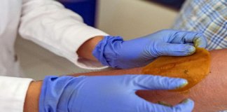 Novo adesivo regenera pele de diabéticos e evita amputação