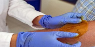 Novo adesivo regenera pele de diabéticos e evita amputação