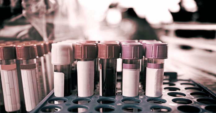 Novo exame de sangue detecta até 8 tipos de câncer