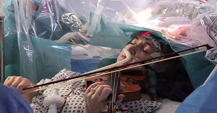 Paciente toca violino durante cirurgia no cérebro para retirada de tumor