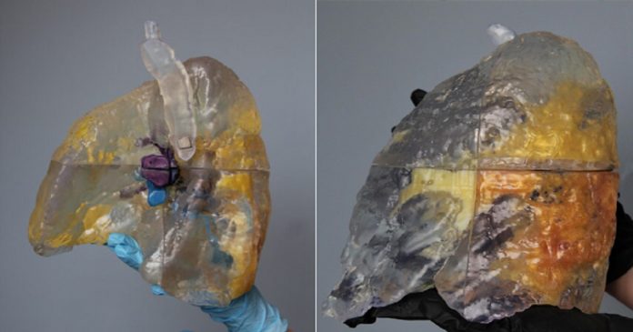 Tecnologia 3D mostra como são os pulmões afetados pela Covid-19