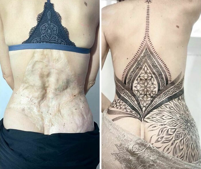 agrandeartedeserfeliz.com - Os tatuadores criam belos designs para cobrir cicatrizes e marcas de nascença