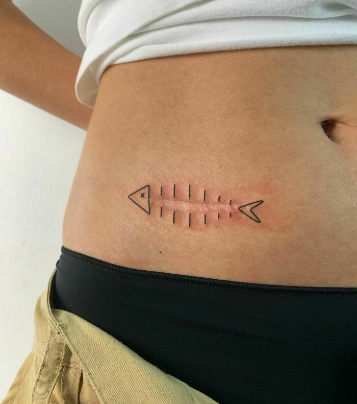 agrandeartedeserfeliz.com - Os tatuadores criam belos designs para cobrir cicatrizes e marcas de nascença