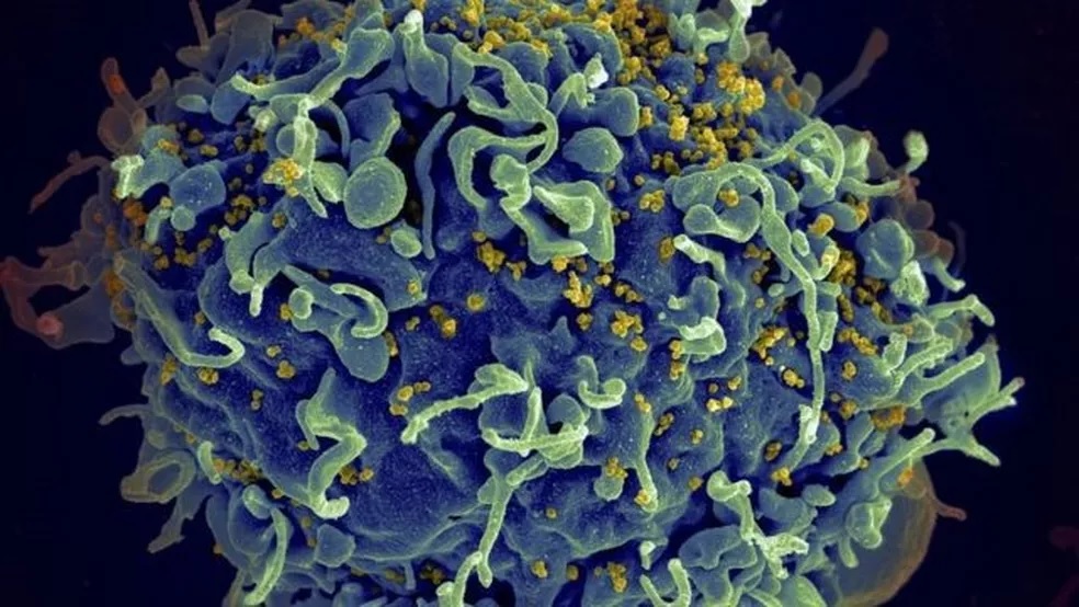 fotos-razoes-primeira-mulher-curada-hiv-3