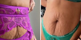 Marca de lingerie escolhe “mulheres reais”, com estrias, para estrelar sua nova coleção