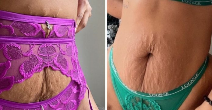 Marca de lingerie escolhe “mulheres reais”, com estrias, para estrelar sua nova coleção