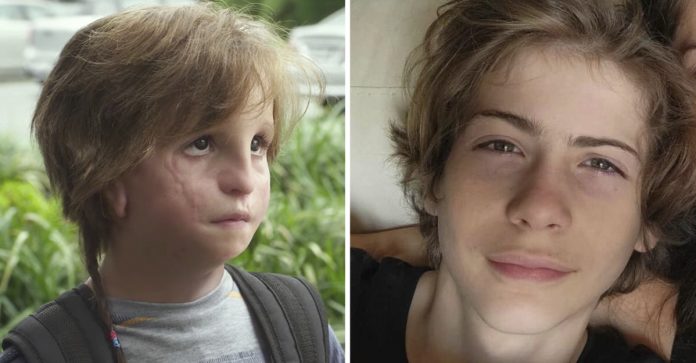 O antes e depois de 19 atores mirins que fizeram sucesso na TV e no cinema